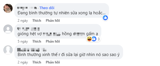 Choáng! Gấm Kami bước vào đường đua "dao kéo", thay đổi cả gương mặt - Ảnh 3.