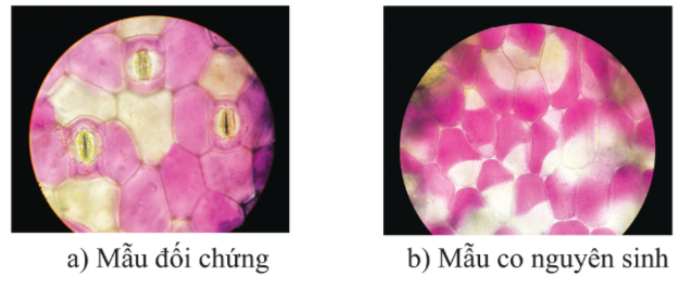 Mô tả hình dạng và vẽ các tế bào biểu bì và các tế bào cấu tạo nên khí khổng ở mẫu đối chứng (ảnh 1)