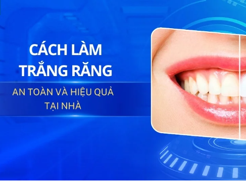 10 Cách Làm Trắng Răng Tại Nhà Bằng Nguyên Liệu Tự Nhiên